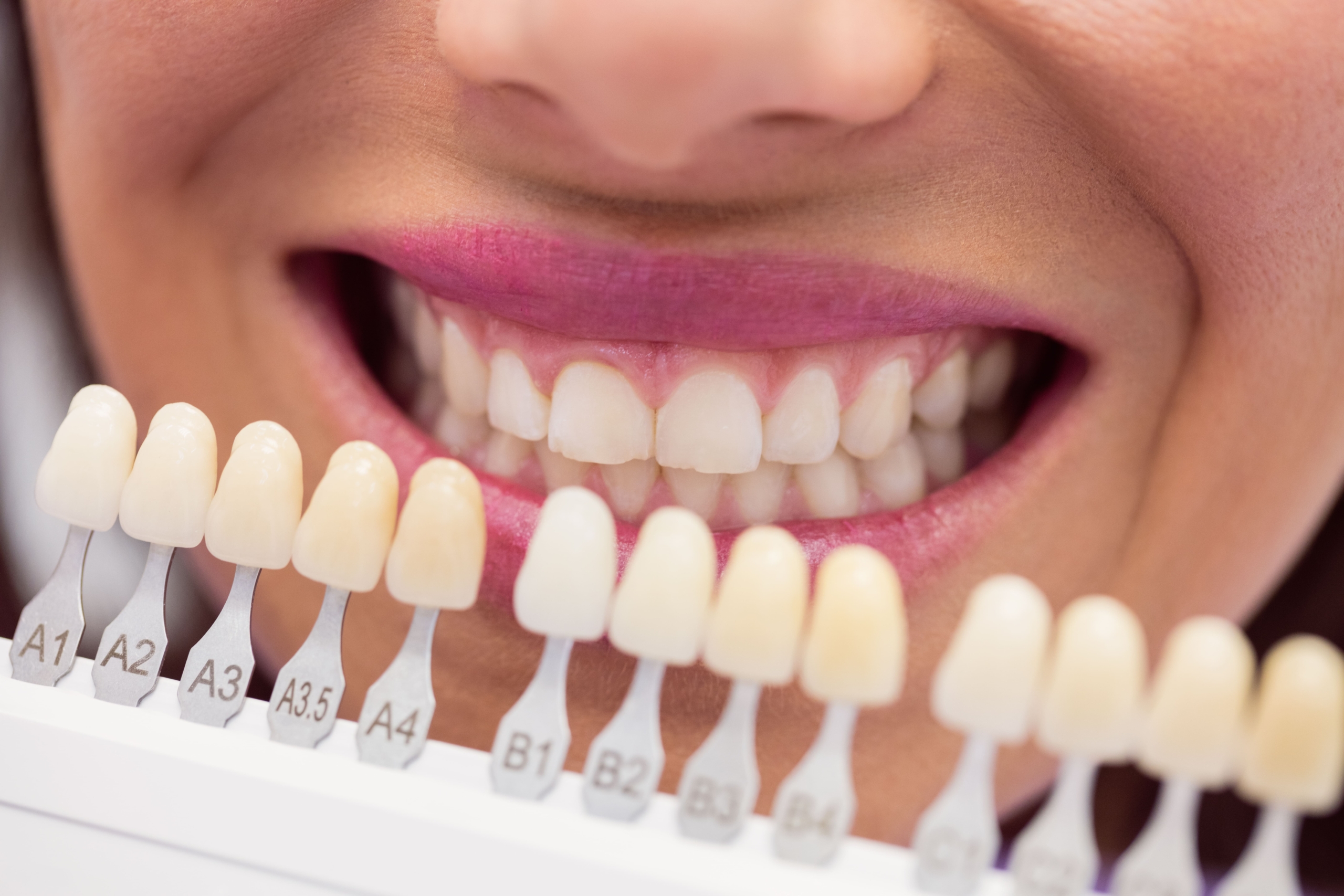 Nord Dental Clinic İzmir gülüş tasarımı